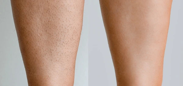SilmTrim-Shaver